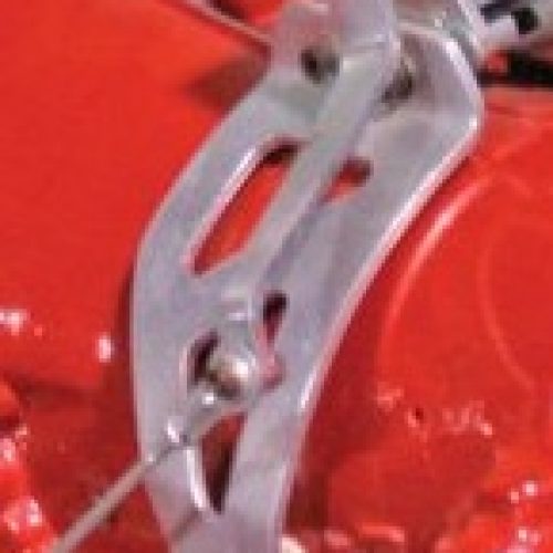 GENNIE SHIFTER TRANS BKT 200R4GM 200R4                 EA